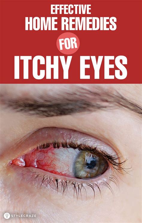 13 home remedies for itchy eyes causes and prevention tips itchy eyes allergy eyes itchy