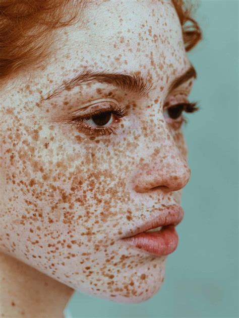 Exploring Freckles From Indiana To Ontario Inside The Making Of The