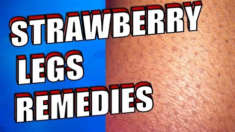 How To Get Rid Of Strawberry Legs The Best Home Remedies Youtube