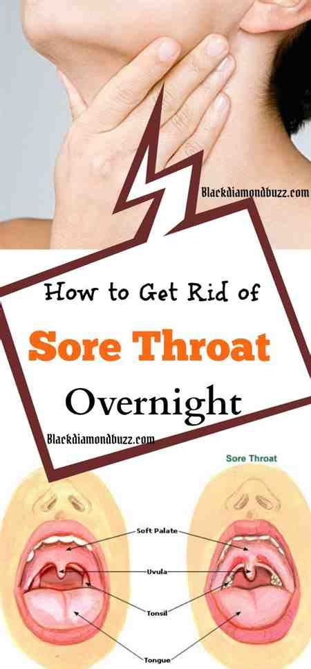 Try vinegar and honey | kaiser permanente. Sore Throat In Germany Sore For Instantly Throat Cure ...