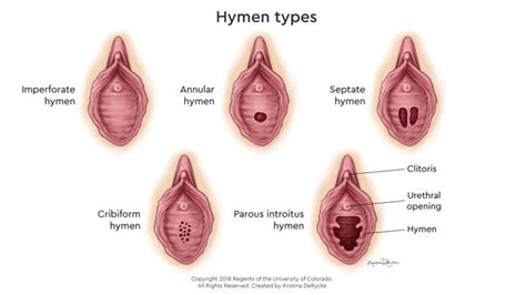 Hymen