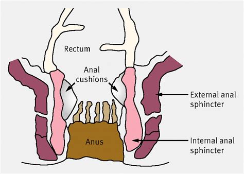 Management Of Faecal Incontinence In Adults The Bmj