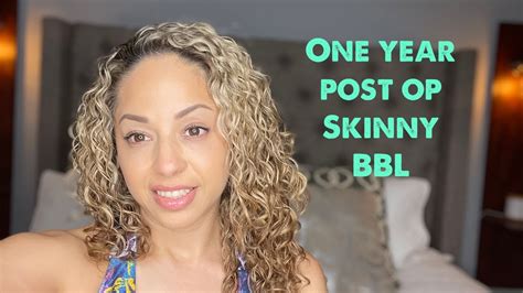 One Year Post Op Skinny Bbllipo 360 Youtube