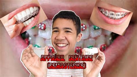 L appareil dentaire remastérisé YouTube