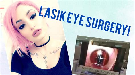 My Lasik Eye Surgery Experience Surgery Footage Included