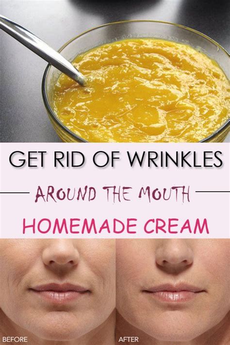 Get Rid Of Wrinkles Around The Mouth Anti Aging Homemade Homemade