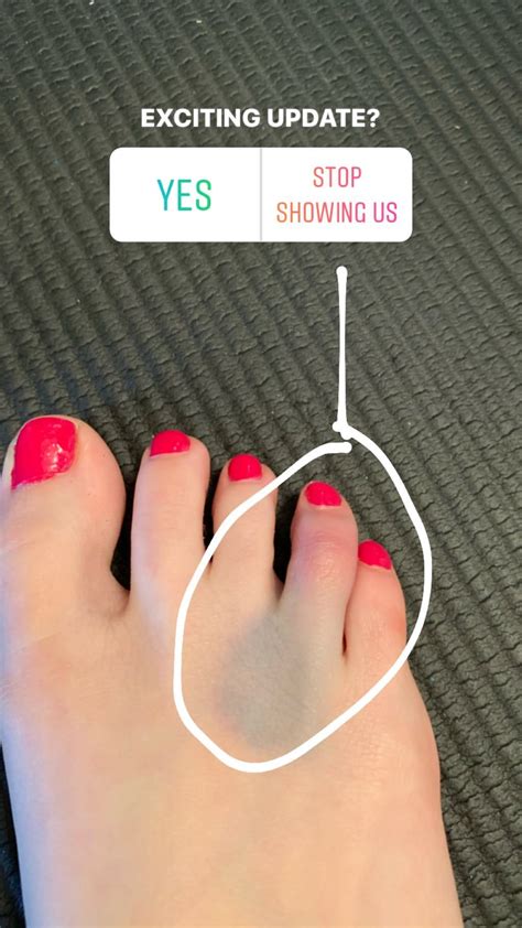 Allison Raskin S Feet