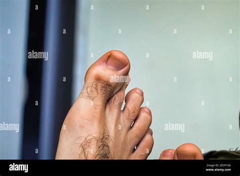 Hairy Toes Hi Res Stock Photography And Images Alamy