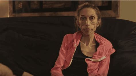 anorexic woman makes dramatic transformation