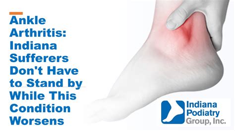 Ankle Arthritis Explained By An Indianapolis Foot Surgeon Indiana
