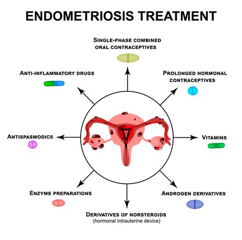 Endometriosis And Its Treatment