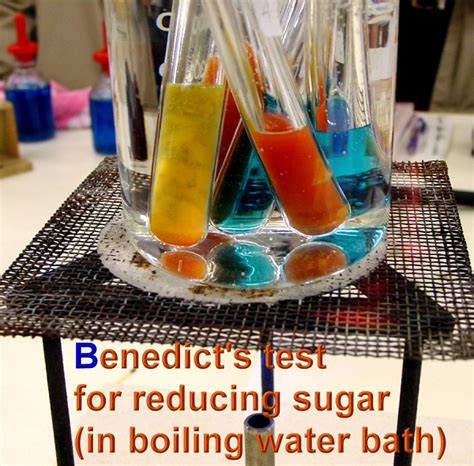 31 Food Test 2 Benedicts Test For Reducing Sugars Biology Notes
