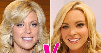 Kate Gosselin Plastic Surgery Facelift Before And After Photos Famous
