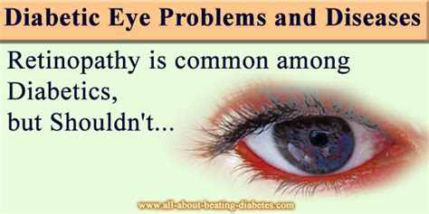 Diabetic Eye Problems And Diseases