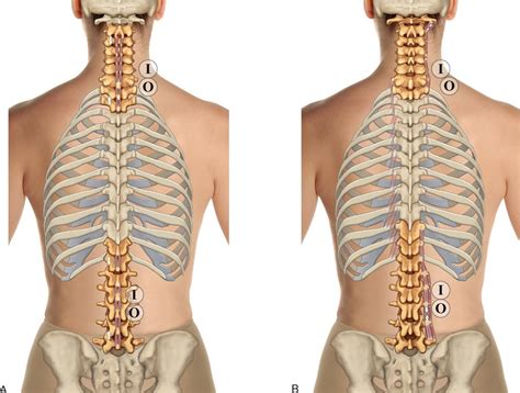 Proper anatomical name for muscles around rib cage. Proper Anatomical Name For Muscles Around Rib Cage / How To Fix Rhomboid Pain ð —£ ð —¥ð —²ð —µð ...
