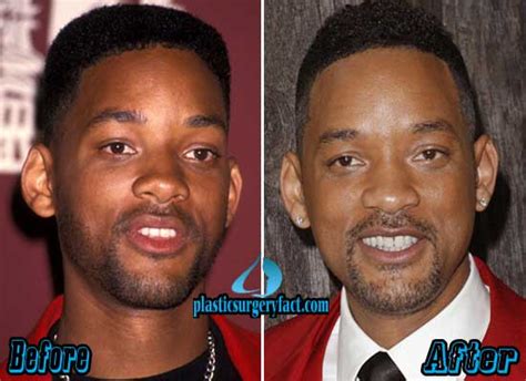 Will Smith Plastic Surgery Before After Pictures Plastic Surgery Facts
