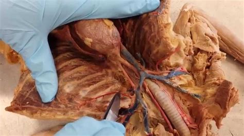 Blood vessels (arteries and veins) in the lower neck and upper chest area . csm cat veins and arteries - YouTube