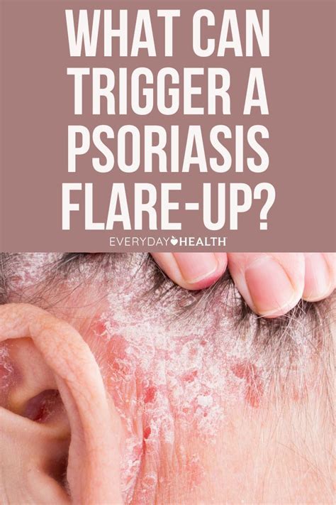What Is Psoriasis Symptoms Causes Diagnosis Treatment And Prevention