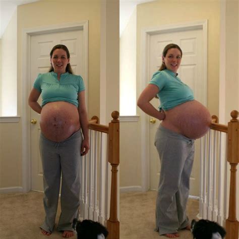 Triplet Pregnancy Triplets Pregnancy Pregnant Belly Huge Pregnant