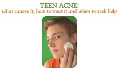 Teen Acne What Causes It How To Treat It And When To Seek Help Kc