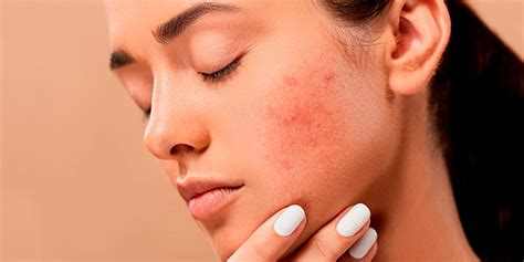 5 Highly Effective Methods For Getting Rid Of Textured Skin