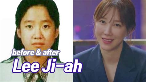Lee Ji Ah Plastic Surgery Lee Ji Ah Before And After 답을 믿으세요