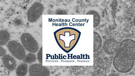 First Monkeypox Case Reported In Moniteau County