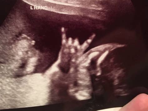 Couple Shocked To See Baby In Sonogram Flashing The Rock On Sign