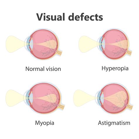 How Glasses Work To Correct Vision Moomoomath And Science
