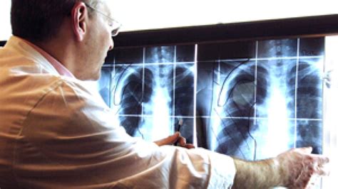 X Rays Often Repeated For Patients In Developing Countries Iaea