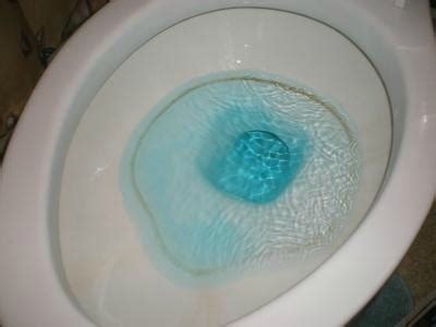 Removing Stains Above Toilet Water Line | ThriftyFun