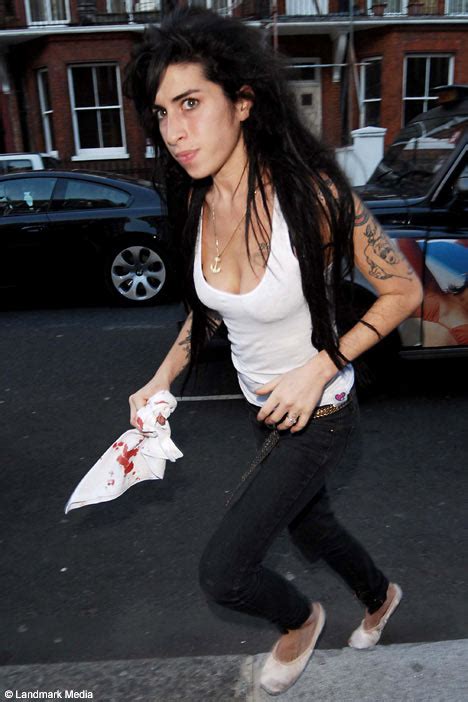 Bloodied Amy Back To Her Bad Old Ways Daily Mail Online