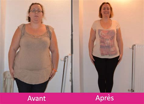 Le docteur guillaume lemierre exerce à bordeaux et à royan depuis plus d'une dizaine d'années et est spécialisé dans la chirurgie de la silhouette et dans la prise en charge de la chirurgie bariatrique. Bypass gastrique Tunisie - Tarifs bypass chirurgie obesite ...