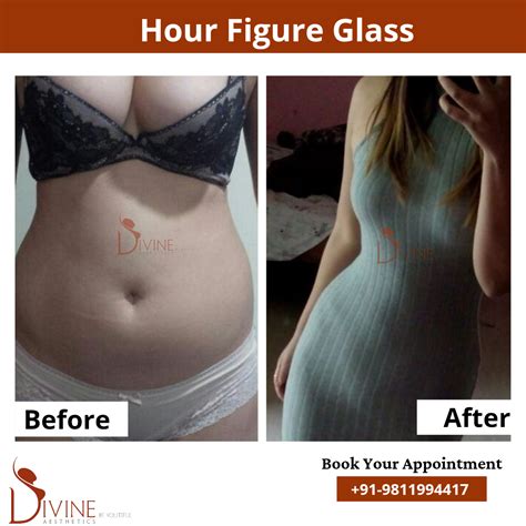 Get Hourglass Surgery And Know Hourglass Figure Surgery Cost