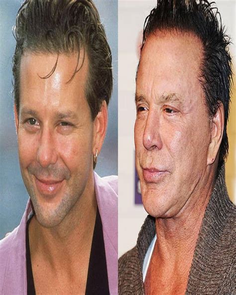 Swan Plastic Surgery Show Before And After Celebrity Plastic Surgery