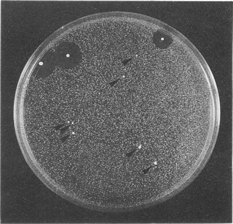 Presumptive Pls Pit And Pis Plt Colonies Isolated After Incubation Of