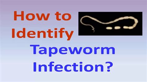 How To Identify Tapeworm Infection Youtube