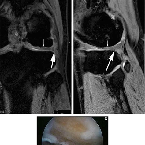 Magnetic Resonance Imaging Of The Knee On Presentation Anterior