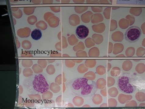 Lymphocytes And Monocytes 1 Flickr Photo Sharing