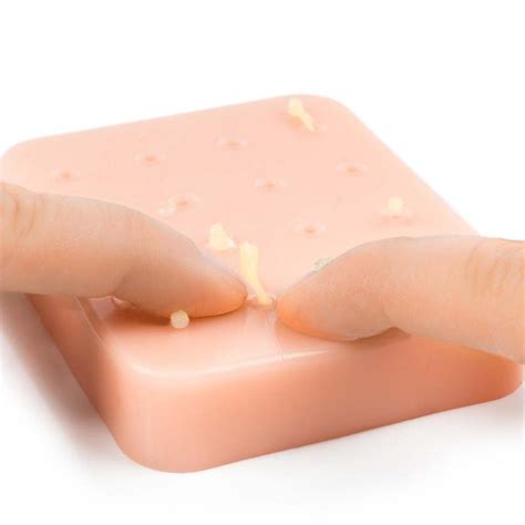 Geeignet für kinder ab 5 jahren. Pimple Pop - Das ultimative Spielzeug zum Pickel ausdrücken