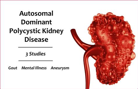 Polycystic Kidney Disease And Aneurysms Captions Lovely