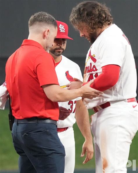 Photo St Louis Cardinals Alec Burleson Fractures Thumb