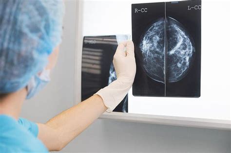 New Treatment Options For Advanced Breast Cancer