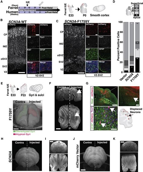 Sodium Channel Scn3a Nav13 Regulation Of Human Cerebral Cortical