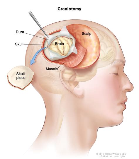 Those that grow in infants and children are very different from those in adults. What is Brain Tumor, Causes and Symptoms ? — Your Daily ...