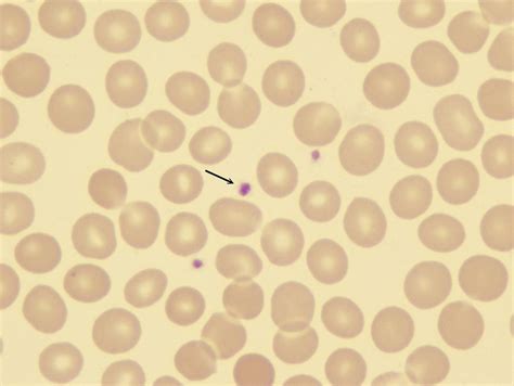 Platelets Biological Science Picture Directory