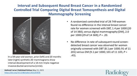 Interval And Subsequent Round Breast Cancer In A Randomized Controlled