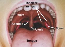 Tonsils are the soft, fleshy structures that are located in the throat. Enlarged Adenoids - treatment of Enlarged Adenoids , types ...