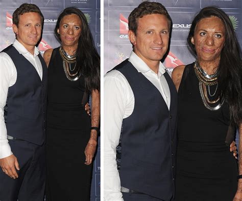 Turia Pitt And Michael Hoskin Love Story In Pictures