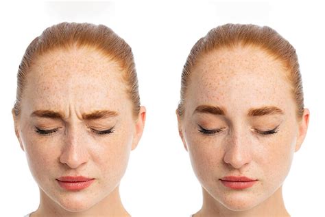 Expert Ways Of How To Get Rid Of Frown Lines Aka 11 Lines Without Boto Maryann Organics